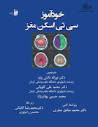 خودآموز سی  تی اسکن مغز